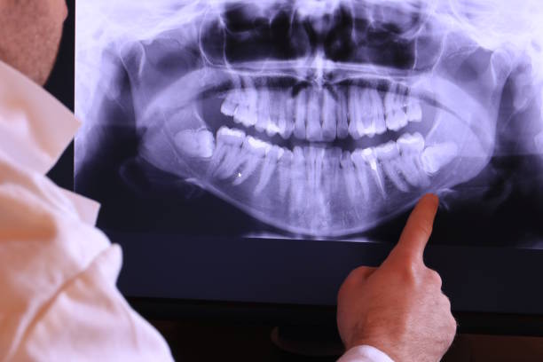 Best Emergency Dentist for Special Needs Patients in Pasadena, MD